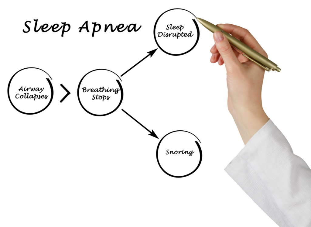 Your Turlock Dentist Can Treat Sleep Apnea - Cabral & Teixeira Family ...