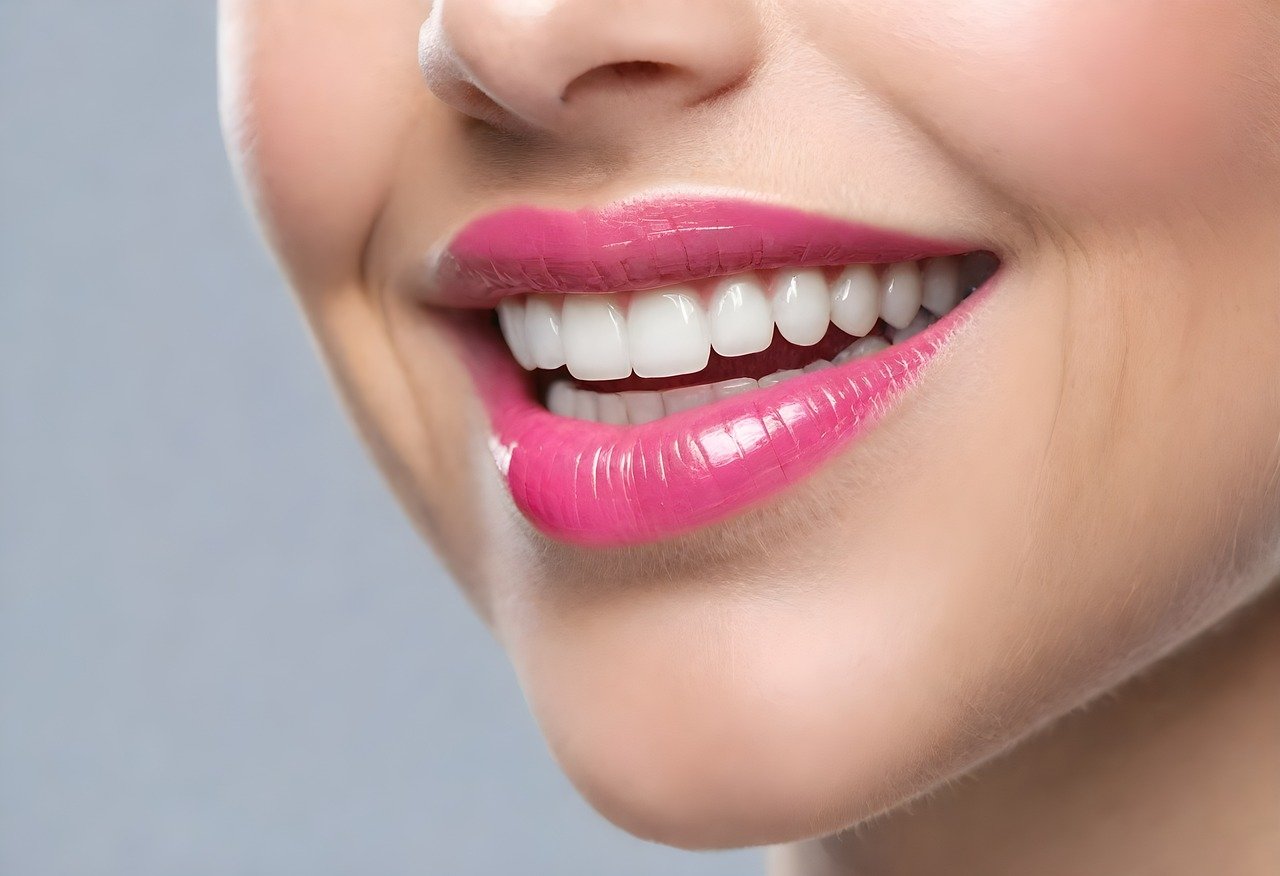 porcelain_veneers_Turlock_dentist